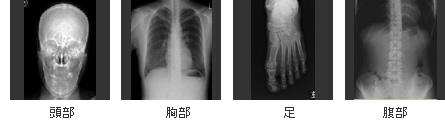 頭部・胸部・足・腹部のレントゲン