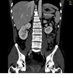 輪切り画像を重ね合わせ