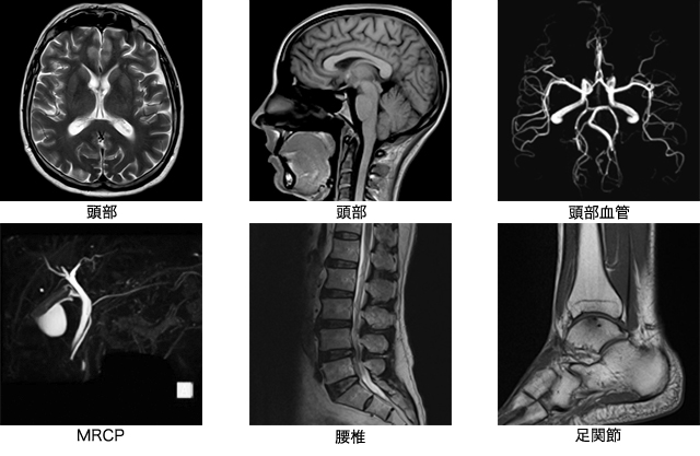 MRI写真の種類
