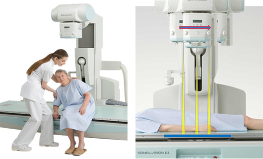 X線骨密度測定装置