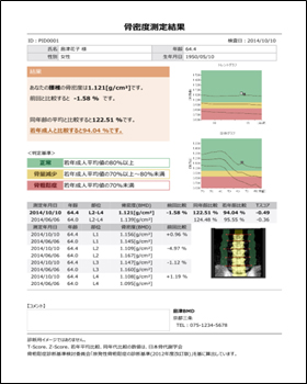 X線骨密度測定装置